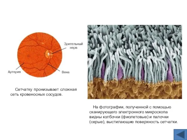 На фотографии, полученной с помощью сканирующего электронного микроскопа видны колбочки (фиолетовые)