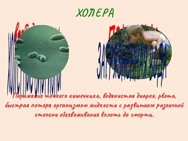 ХОЛЕРА ХОЛЕРНЫЕ ВИБРИОНЫ возбудители ПРИЧИНЫ Поражение тонкого кишечника, водянистая диарея, рвота,