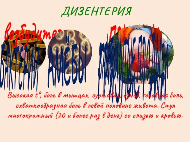 ДИЗЕНТЕРИЯ возбудители БАКТЕРИИ АМЁБЫ ПРИЧИНЫ ГРЯЗНЫЕ РУКИ ЗАГРЯЗНЁННАЯ ВОДА Высокая t°,