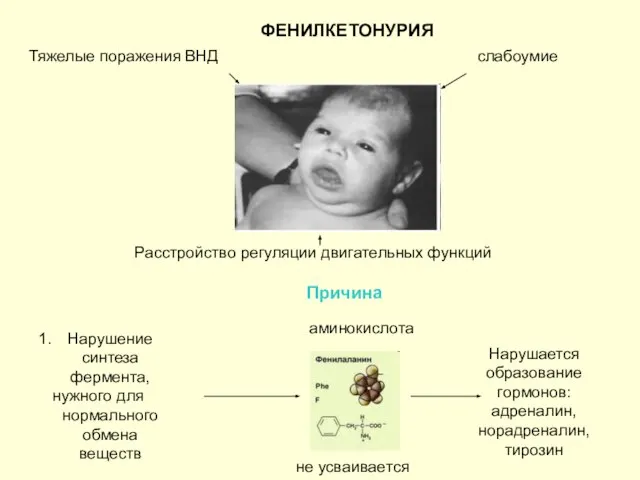 ФЕНИЛКЕТОНУРИЯ Тяжелые поражения ВНД слабоумие Расстройство регуляции двигательных функций Причина Нарушение