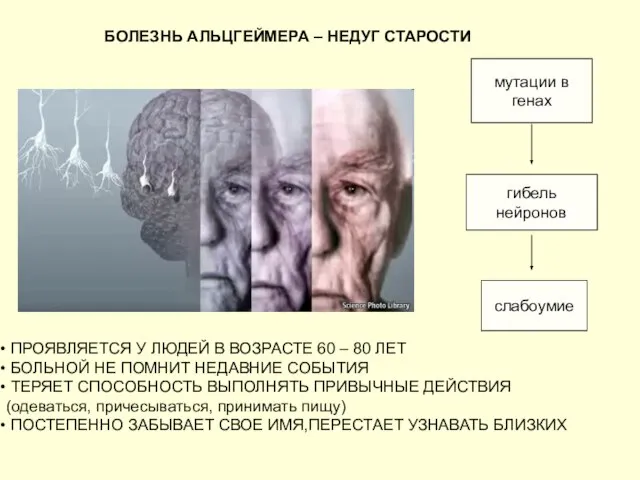 БОЛЕЗНЬ АЛЬЦГЕЙМЕРА – НЕДУГ СТАРОСТИ ПРОЯВЛЯЕТСЯ У ЛЮДЕЙ В ВОЗРАСТЕ 60