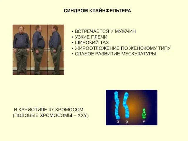 СИНДРОМ КЛАЙНФЕЛЬТЕРА ВСТРЕЧАЕТСЯ У МУЖЧИН УЗКИЕ ПЛЕЧИ ШИРОКИЙ ТАЗ ЖИРООТЛОЖЕНИЕ ПО