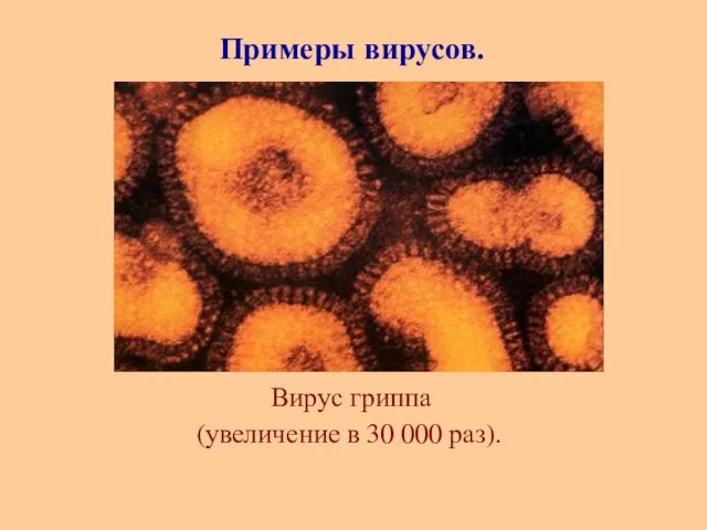 Вирус гриппа (увеличение в 30 000 раз). Примеры вирусов.