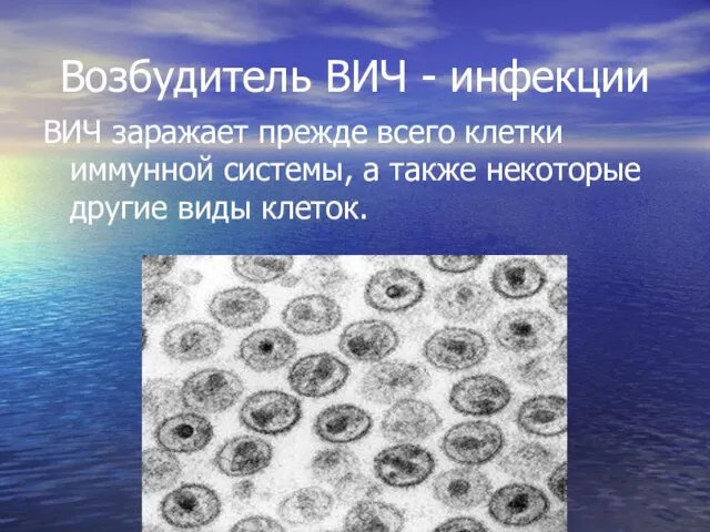 Возбудитель ВИЧ - инфекции ВИЧ заражает прежде всего клетки иммунной системы,