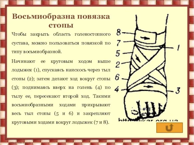 Восьмиобразна повязка стопы Чтобы закрыть область голеностопного сустава, можно пользоваться повязкой