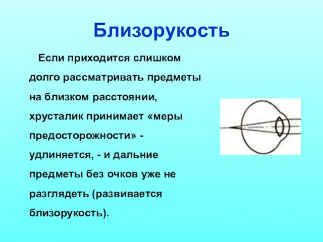 Близорукость Если приходится слишком долго рассматривать предметы на близком расстоянии, хрусталик