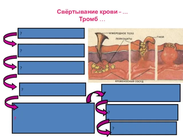 Свёртывание крови – … Тромб … ? ? ? ? ? ? ? ?