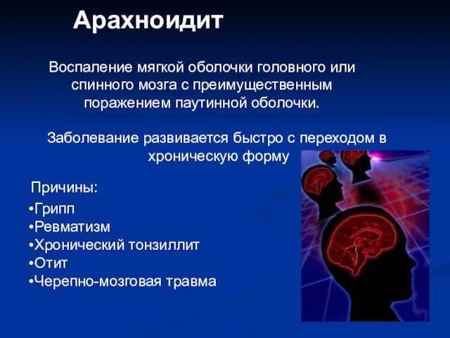 Арахноидит Воспаление мягкой оболочки головного или спинного мозга с преимущественным поражением