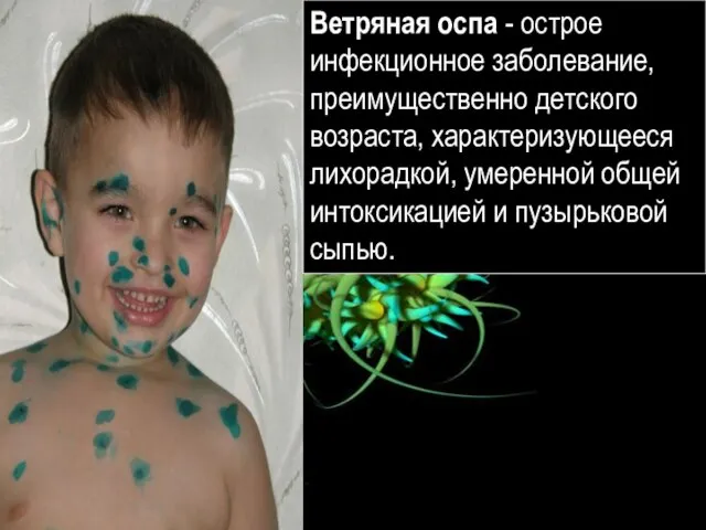 Ребёнок, болеющий ветряной оспой Ветряная оспа - острое инфекционное заболевание, преимущественно