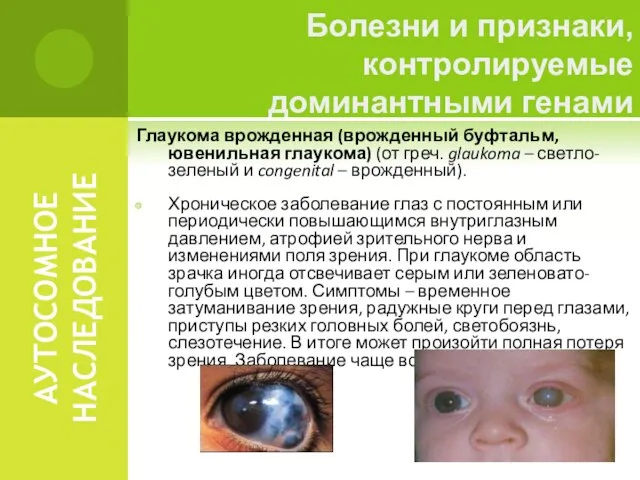 АУТОСОМНОЕ НАСЛЕДОВАНИЕ Глаукома врожденная (врожденный буфтальм, ювенильная глаукома) (от греч. glaukoma
