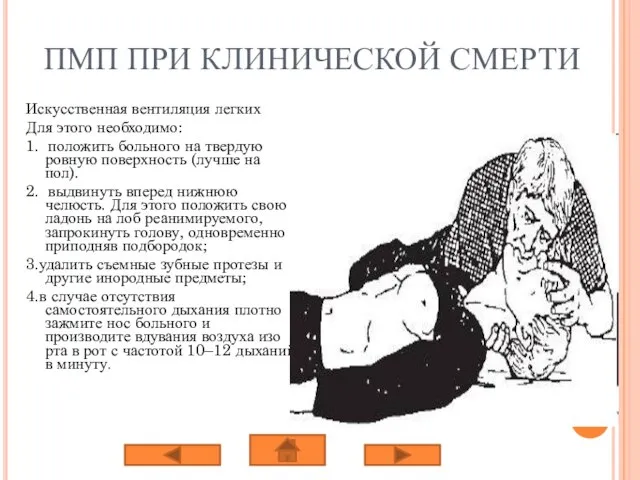 ПМП ПРИ КЛИНИЧЕСКОЙ СМЕРТИ Искусственная вентиляция легких Для этого необходимо: 1.