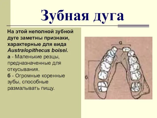 Зубная дуга На этой неполной зубной дуге заметны признаки, характерные для