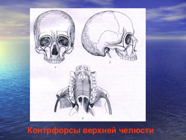 Контрфорсы верхней челюсти