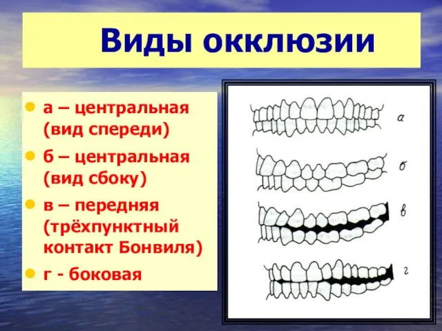 Виды окклюзии а – центральная (вид спереди) б – центральная (вид