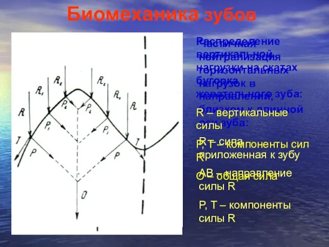 Биомеханика зубов Частичная нейтрализация горизонтальных нагрузок в направлении, близком к длинной