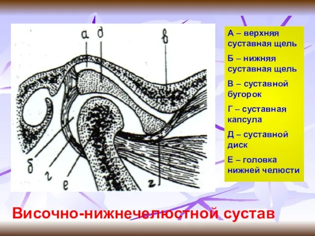 Височно-нижнечелюстной сустав А – верхняя суставная щель Б – нижняя суставная