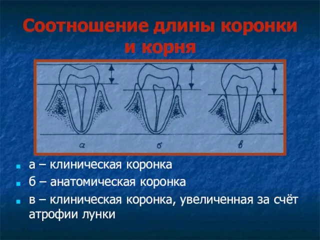 Соотношение длины коронки и корня а – клиническая коронка б –