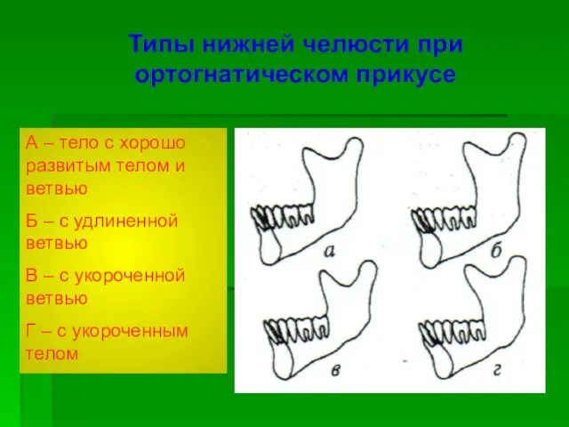 Типы нижней челюсти при ортогнатическом прикусе А – тело с хорошо