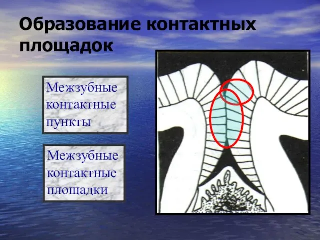 Образование контактных площадок Межзубные контактные пункты Межзубные контактные площадки