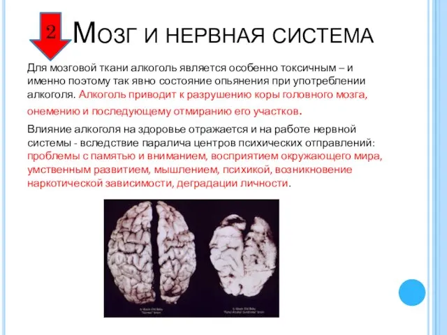 Мозг и нервная система Для мозговой ткани алкоголь является особенно токсичным