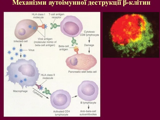 Механізми аутоімунної деструкції β-клітин