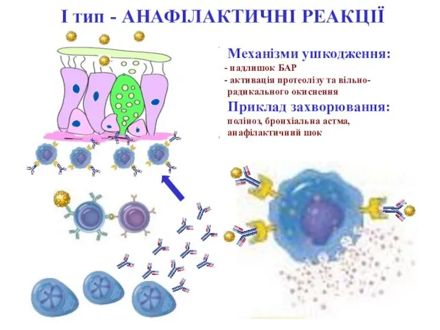 І тип - АНАФІЛАКТИЧНІ РЕАКЦІЇ Механізми ушкодження: надлишок БАР активація протеолізу