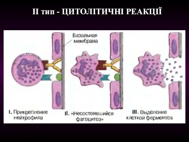 ІІ тип - ЦИТОЛІТИЧНІ РЕАКЦІЇ