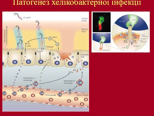 Патогенез хелікобактерної інфекції