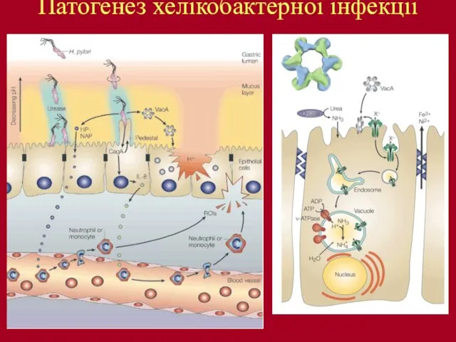 Патогенез хелікобактерної інфекції