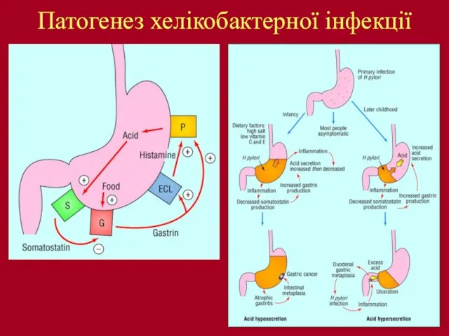 Патогенез хелікобактерної інфекції