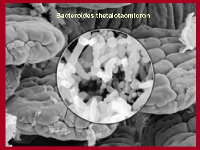 Bacteroides thetaiotaomicron Bacteroides thetaiotaomicron