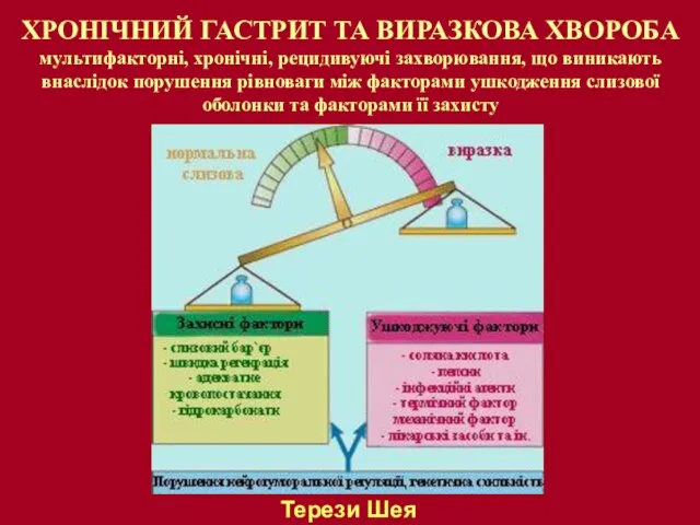 ХРОНІЧНИЙ ГАСТРИТ ТА ВИРАЗКОВА ХВОРОБА мультифакторні, хронічні, рецидивуючі захворювання, що виникають