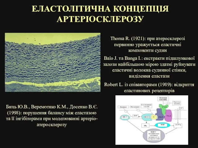 ЕЛАСТОЛІТИЧНА КОНЦЕПЦІЯ АРТЕРІОСКЛЕРОЗУ Thoma R. (1921): при атеросклерозі первинно уражується еластичні