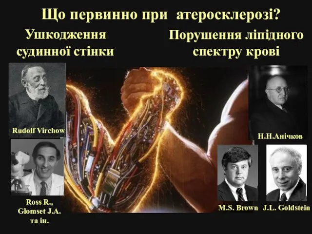 Що первинно при атеросклерозі? Ушкодження судинної стінки Порушення ліпідного спектру крові