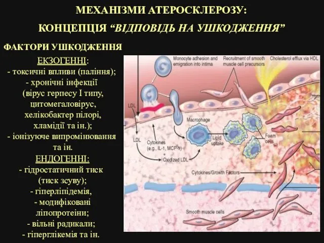 МЕХАНІЗМИ АТЕРОСКЛЕРОЗУ: КОНЦЕПЦІЯ “ВІДПОВІДЬ НА УШКОДЖЕННЯ” ФАКТОРИ УШКОДЖЕННЯ ЕКЗОГЕННІ: токсичні впливи