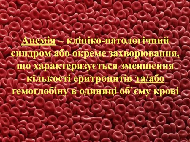 Анемія – клініко-патологічний синдром або окреме захворювання, що характеризується зменшення кількості