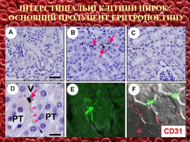 ІНТЕРСТИЦІАЛЬНІ КЛІТИНИ НИРОК – ОСНОВНИЙ ПРОДУЦЕНТ ЕРИТРОПОЕТИНУ