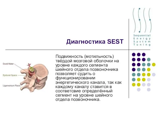 Диагностика SEST Подвижность (мотильность) твёрдой мозговой оболочки на уровне каждого сегмента