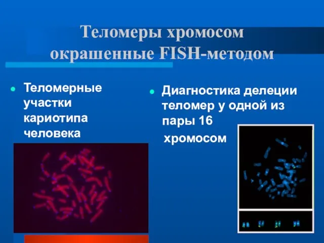 Теломеры хромосом окрашенные FISH-методом Теломерные участки кариотипа человека Диагностика делеции теломер