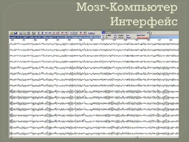 Мозг-Компьютер Интерфейс