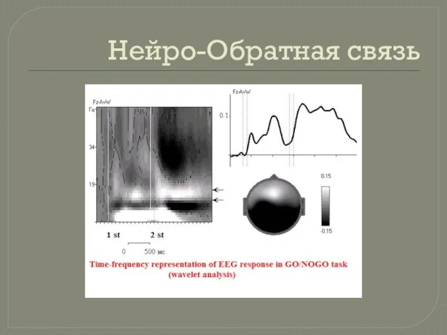 Нейро-Обратная связь