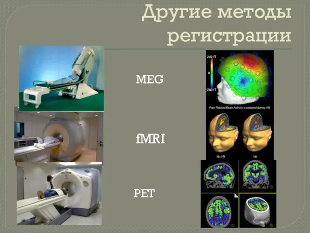Другие методы регистрации fMRI PET MEG