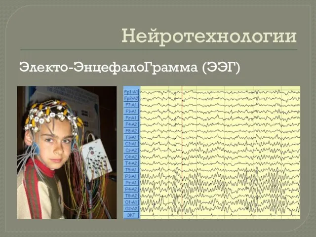 Нейротехнологии Электо-ЭнцефалоГрамма (ЭЭГ)