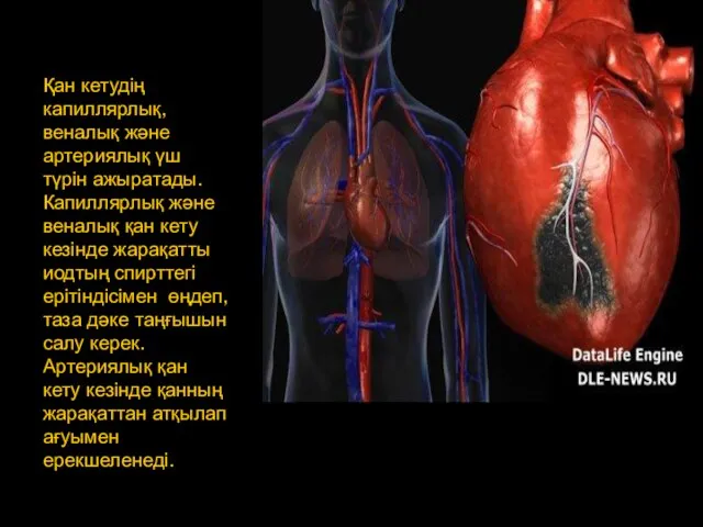 Қан кетудің капиллярлық, веналық және артериялық үш түрін ажыратады. Капиллярлық және