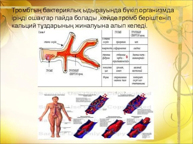 Тромбтың бактериялық ыдырауында бүкіл организмда іріңді ошақтар пайда болады ,кейде тромб