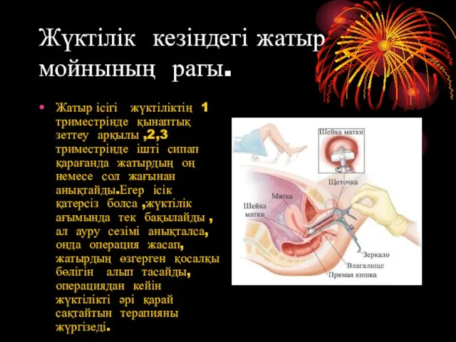 Жүктілік кезіндегі жатыр мойнының рагы. Жатыр ісігі жүктіліктің 1 триместрінде қынаптық