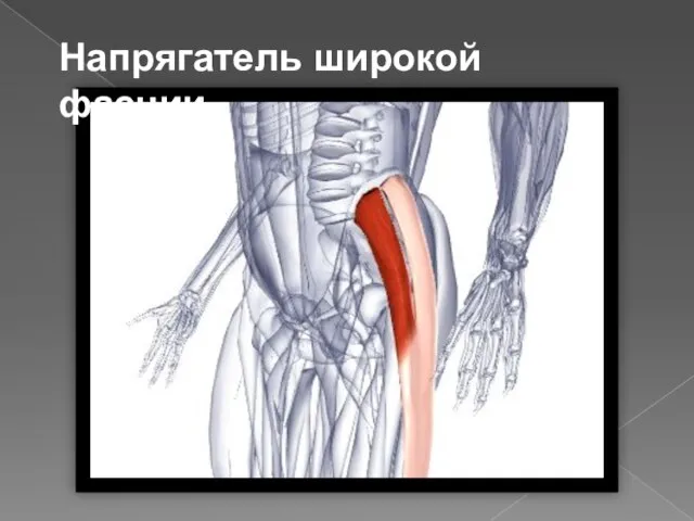 Напрягатель широкой фасции