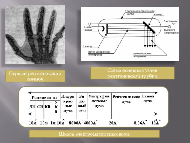 Первый рентгеновский снимок Шкала электромагнитных волн Схема основных узлов рентгеновской трубки