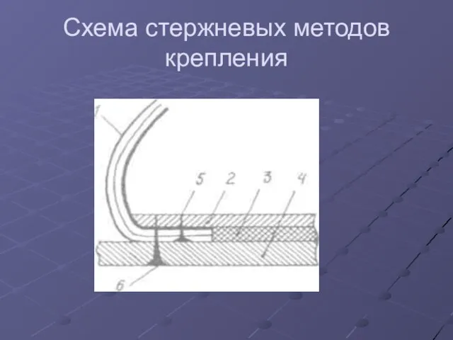 Схема стержневых методов крепления