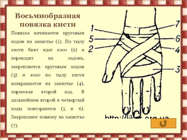 Восьмиобразная повязка кисти Повязка начинается круговым ходом на запястье (1). По